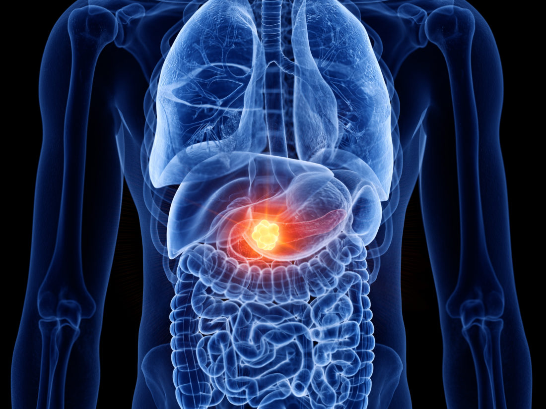 Game-changing cancer therapy | Innovators magazine